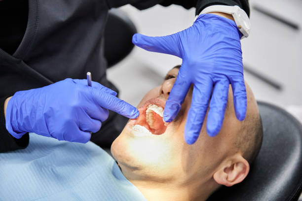 Best Emergency Treatment for Toothache in Shasta, CA