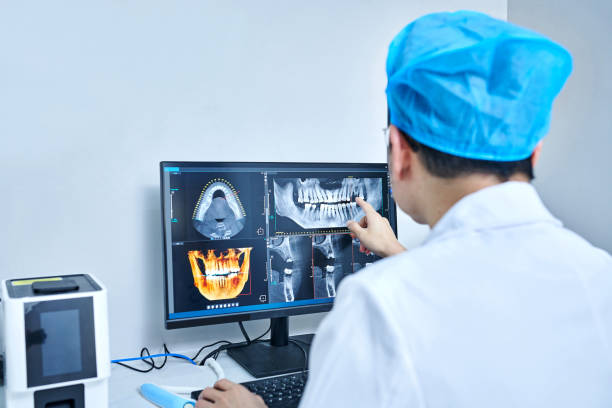 Best Emergency Wisdom Teeth Removal in Shasta, CA