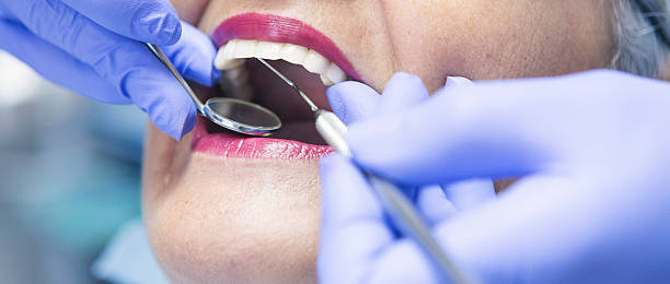 Best Emergency Wisdom Teeth Removal in Shasta, CA